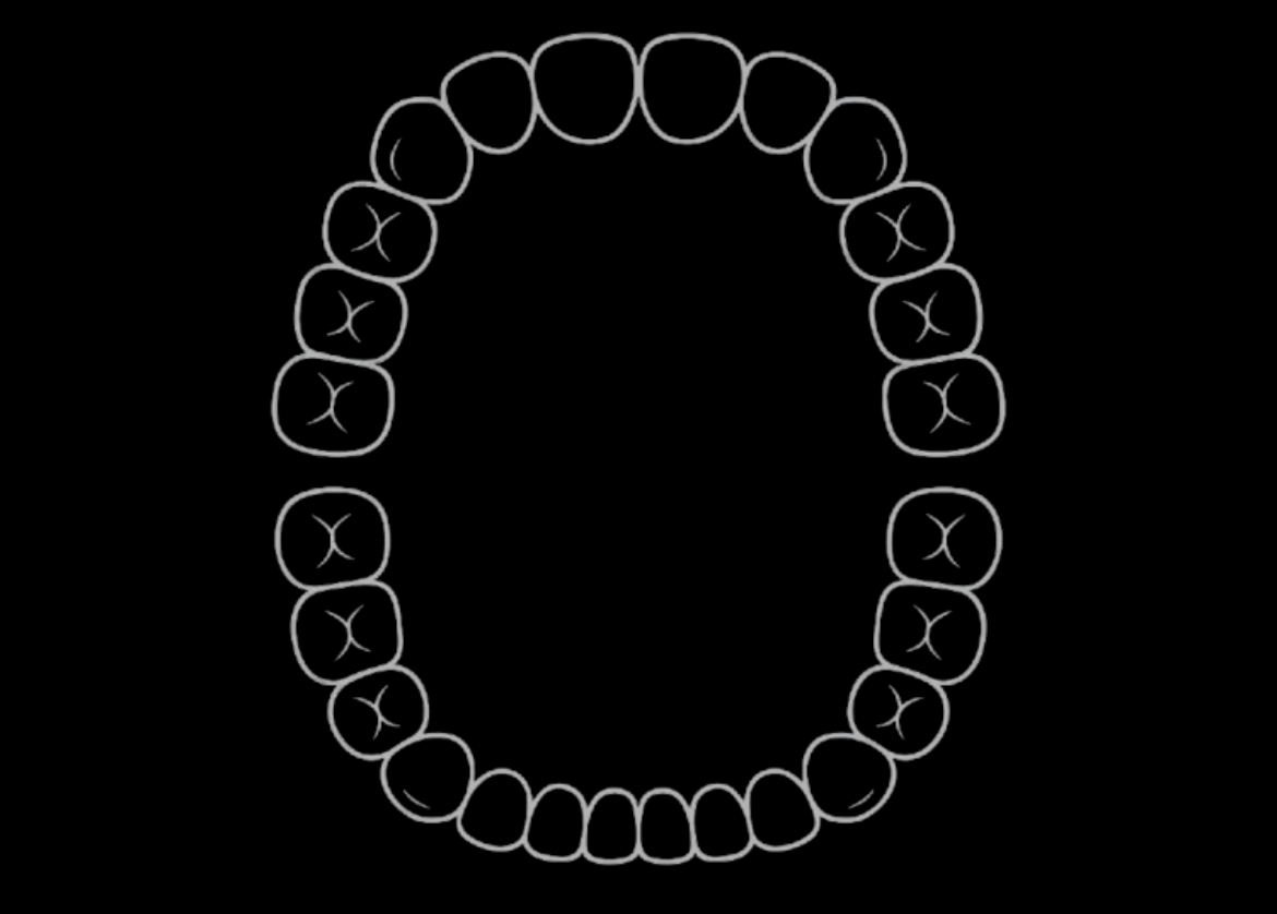 Brushing Timer App screen highlighting the Upper Outer Left brushing area, created by CGWebTech.